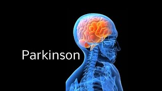 Parkinson leicht erklärt Einfach erklärt [upl. by Asselim575]