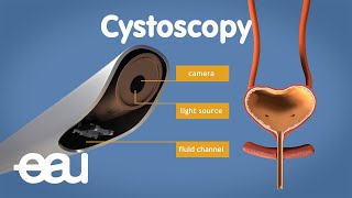 Intravenous IV Cannulation  An Essential Guide [upl. by Lot]