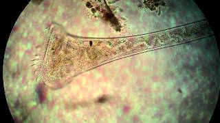 Protist under the microscope [upl. by Smail959]