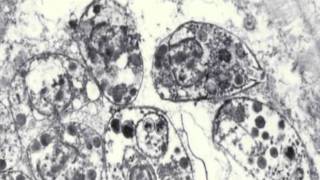 Toxoplasmosis amp Toxoplasma gondii [upl. by Zilevi826]