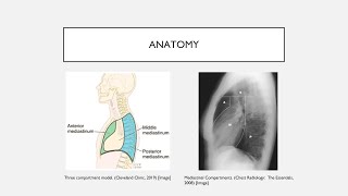 Mediastinal Masses [upl. by Aurore]