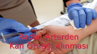 Radial Arterden Kan Gazı Alma Pratiği [upl. by Nottarts]