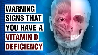 14 Signs Of Vitamin D Deficiency [upl. by Milty]