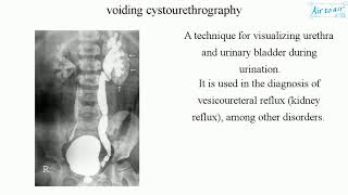 Bronchoscopy Procedure South West Acute Hospital [upl. by Airebma]