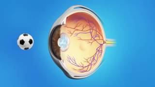 Cystoscopy overactive bladder [upl. by Eifos]