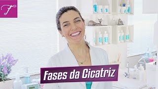 Sua cicatriz está em qual fase [upl. by Cheslie]