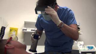 Cryotherapy treatment for skin [upl. by Kramer]