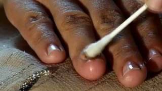 How to Cure Nail Fungus [upl. by Leta]