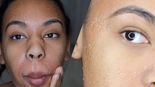 How to get rid of dry skin Literally RUB all the DEAD SKIN off your FACE [upl. by Sirapal]