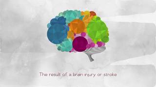 What is Brocas Aphasia [upl. by Aldon]