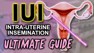 IUI  Fertility expert secrets for maximum pregnancy rates [upl. by Skoorb458]