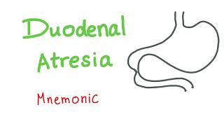 Duodenal Atresia Mnemonic [upl. by Soma]