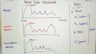 Serum Protein Electrophoresis importance and result interpretation in an easy way [upl. by Derinna]