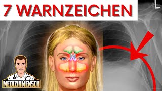 AUTOIMMUNERKRANKUNG Immunattacken erkennen RheumaArzt erklärt Warnzeichen [upl. by Chappie878]