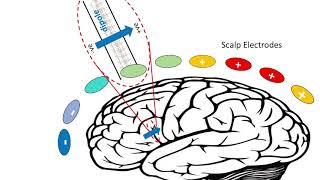 EEG  Electrical Brainwaves [upl. by Main]