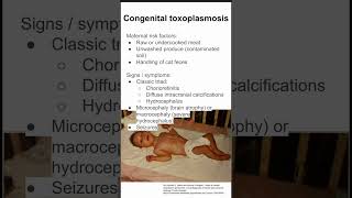 Toxoplasmosis Infection Awareness Minute  five Essential Facts [upl. by Patt156]