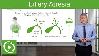 Biliary Atresia – Pediatrics  Lecturio [upl. by Norman]