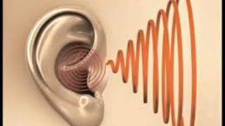 Extremely Powerful Tinnitus Sound Therapy  Remedy for Tinnitus Ears Sound [upl. by Neirad]