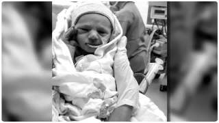 Parents Have Confidence in Cincinnati Childrens Surgeons to Repair Sons Rare Birth Defect [upl. by Ihcalam]