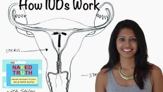 How an IUD Works  Episode 18 [upl. by Dov]