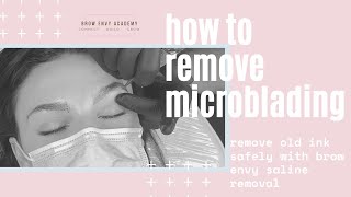 How To Remove Microblading With Saline Tattoo Removal [upl. by Danita565]