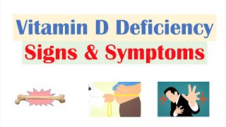 Vitamin D Deficiency Signs amp Symptoms ex Fatigue Diagnosis Treatment [upl. by Suissac499]