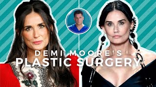 DEMI MOORE BEFORE AND AFTER Beverly Hills Plastic Surgeon Explains What Happened [upl. by Doelling90]