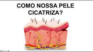 COMO OCORRE A CICATRIZAÇÃO NA PELE Por Luiz Gameiro dermatologista [upl. by Attiuqehs]